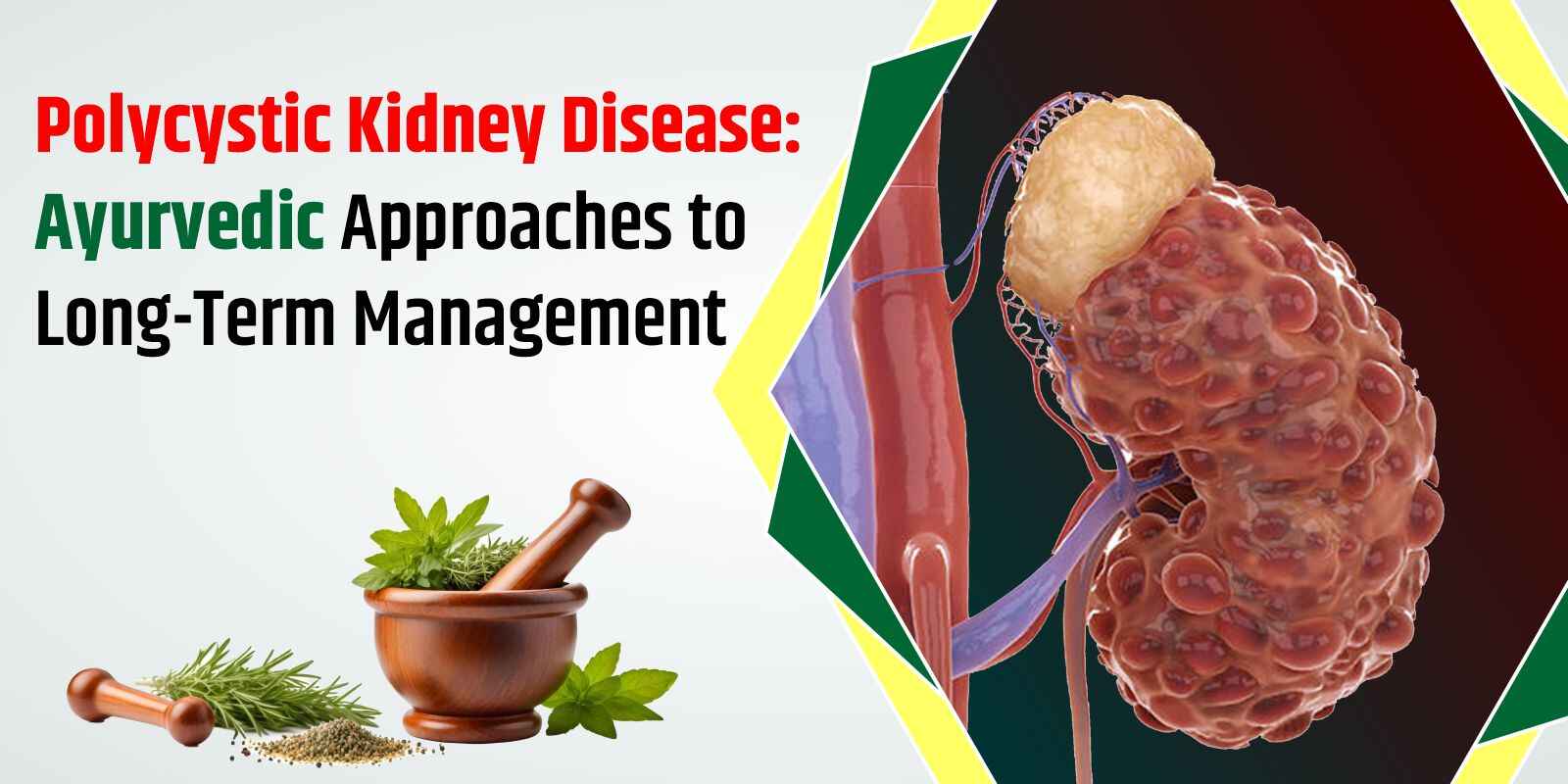 Polycystic Kidney Disease: Ayurvedic Approaches to Long-Term Management